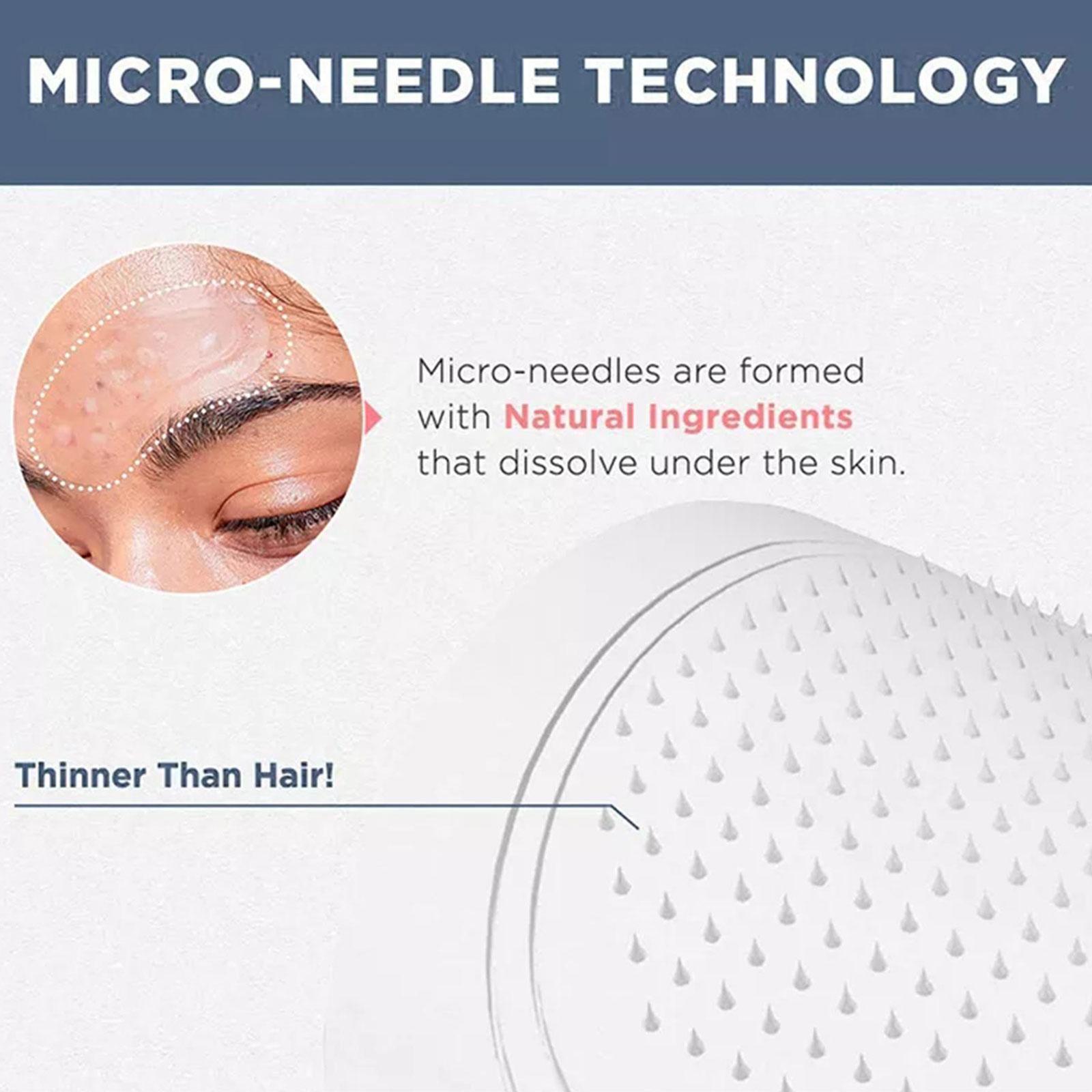 0.2mm Micro-needle Eye Patch M – Eye Pad Collagen Bewertung und Preis
